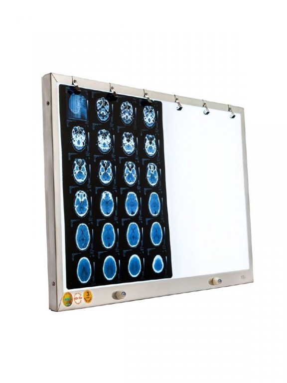 Đèn đọc film MRI-CT-X Quang - Ảnh 4