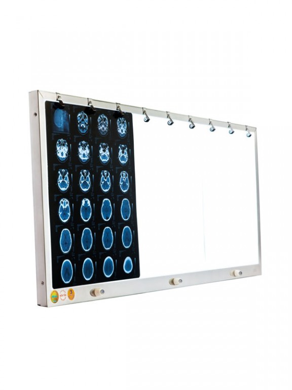 Đèn đọc film MRI-CT-X Quang - Ảnh 5