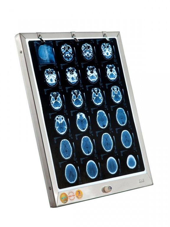 Đèn đọc film MRI-CT-X Quang